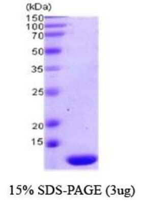 SDS-PAGE Recombinant Human Thioredoxin-2 Protein