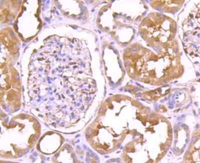 Immunohistochemistry-Paraffin: Thioredoxin Reductase 1/TRXR1 Antibody (JA11-32) [NBP2-67194] - Analysis of paraffin-embedded human kidney tissue using anti-TXNRD1 antibody. Counter stained with hematoxylin.