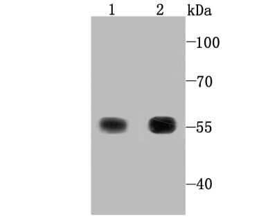 Western Blot: Thioredoxin Reductase 1/TRXR1 Antibody (JA11-32) [NBP2-67194] - Analysis of TXNRD1 on Hela (1) and human liver tissue lysate (2) using anti-TXNRD1 antibody at 1/1,000 dilution.