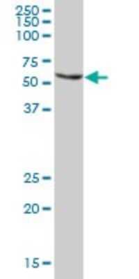 Western Blot: Thioredoxin Reductase 1/TRXR1 Antibody [H00007296-B01P] - Analysis of TXNRD1 expression in human kidney.