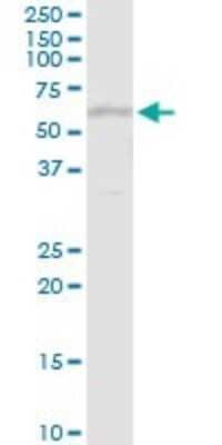 Western Blot: Thioredoxin Reductase 1/TRXR1 Antibody [H00007296-D01P] - Analysis of TXNRD1 expression in HepG2.