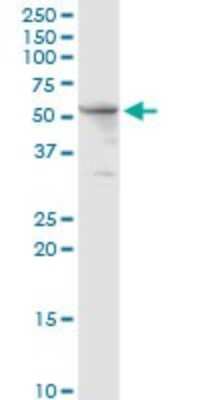 Western Blot: Thioredoxin Reductase 1/TRXR1 Antibody [H00007296-D01P] - Analysis of TXNRD1 expression in human kidney.