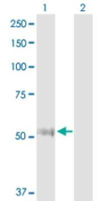 Western Blot: Thioredoxin Reductase 1/TRXR1 Antibody [H00007296-D01P] - Analysis of TXNRD1 expression in transfected 293T cell line by TXNRD1 polyclonal antibody.Lane 1: TXNRD1 transfected lysate(54.50 KDa).Lane 2: Non-transfected lysate.