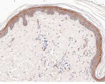 Immunohistochemistry-Paraffin: Thrombomodulin/BDCA-3 Antibody (JB48-23) [NBP2-75683] - Analysis of paraffin-embedded human skin tissue with Rabbit anti-Thrombomodulin/BDCA-3 antibody washed with ddH2O and PBS, and then probed with the primary antibody at 1/200 dilution for 1 hour at room temperature. The detection was performed using an HRP conjugated compact polymer system. DAB was used as the chromogen. Tissues were counterstained with hematoxylin and mounted with DPX.