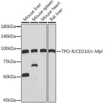 Western Blot: Thrombopoietin R/Tpo R Antibody (5Q9Z6) [NBP3-15880] - Western blot analysis of extracts of various cell lines, using Thrombopoietin R/Tpo R Rabbit mAb (NBP3-15880) at 1:1000 dilution. Secondary antibody: HRP Goat Anti-Rabbit IgG (H+L) at 1:10000 dilution. Lysates/proteins: 25ug per lane. Blocking buffer: 3% nonfat dry milk in TBST. Detection: ECL Basic Kit. Exposure time: 60s.