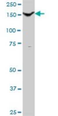 Western Blot: Thrombospondin-1 Antibody [H00007057-B01P] - Analysis of THBS1 expression in human pancreas.