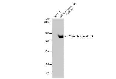 Western Blot: Thrombospondin-2 Antibody (GT147) [NBP3-13654] - AsPC1 whole cell extract and conditioned medium (30 ug) were separated by 5% SDS-PAGE, and the membrane was blotted with Thrombospondin-2 antibody [GT147] (NBP3-13654) diluted at 1:1000. The HRP-conjugated anti-mouse IgG antibody (NBP2-19382) was used to detect the primary antibody.