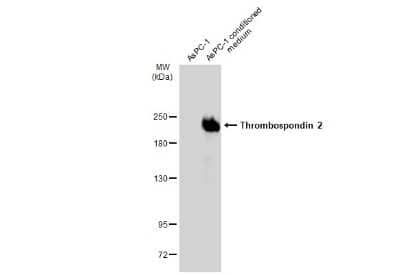 Western Blot: Thrombospondin-2 Antibody (GT7511) [NBP3-13653] - AsPC1 whole cell extract and conditioned medium (30 ug) were separated by 5% SDS-PAGE, and the membrane was blotted with Thrombospondin-2 antibody [GT7511] (NBP3-13653) diluted at 1:1000. The HRP-conjugated anti-mouse IgG antibody (NBP2-19382) was used to detect the primary antibody.