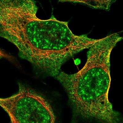 Immunocytochemistry/Immunofluorescence: Thrombospondin-2 Antibody [NBP2-58202] - Staining of human cell line U-2 OS shows localization to nuclear speckles & plasma membrane. Antibody staining is shown in green.