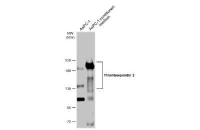 <b>Biological Strategies Validation. </b>Western Blot: Thrombospondin-2 Antibody [NBP3-13398] - AsPC-1 whole cell extract and conditioned medium (30 ug) were separated by 5% SDS-PAGE, and the membrane was blotted with Thrombospondin-2 antibody (NBP3-13398) diluted at 1:1000. The HRP-conjugated anti-rabbit IgG antibody (NBP2-19301) was used to detect the primary antibody.