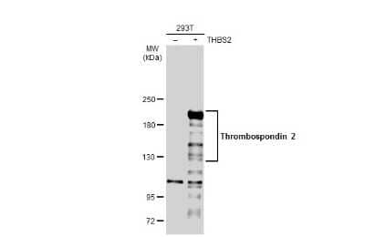 Western Blot: Thrombospondin-2 Antibody [NBP3-13398] - Non-transfected (-) and transfected (+) 293T whole cell extracts (30 ug) were separated by 5% SDS-PAGE, and the membrane was blotted with Thrombospondin-2 antibody (NBP3-13398) diluted at 1:1000. The HRP-conjugated anti-rabbit IgG antibody (NBP2-19301) was used to detect the primary antibody.