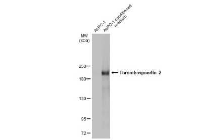 Western Blot: Thrombospondin-2 Antibody [NBP3-13399] - AsPC-1 whole cell extract and conditioned medium (30 ug) were separated by 5% SDS-PAGE, and the membrane was blotted with Thrombospondin-2 antibody (NBP3-13399) diluted at 1:1000. The HRP-conjugated anti-rabbit IgG antibody (NBP2-19301) was used to detect the primary antibody.