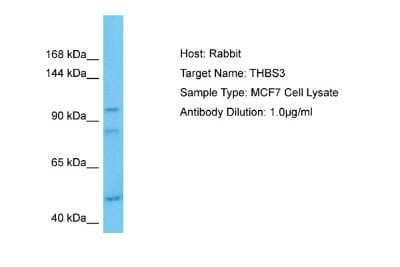 Western Blot: Thrombospondin-3 Antibody [NBP2-85911] - Host: Rabbit. Target Name: THBS3. Sample Tissue: Human MCF7 Whole Cell. Antibody Dilution: 1.0ug/ml