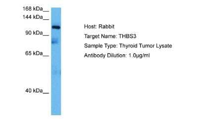 Western Blot: Thrombospondin-3 Antibody [NBP2-85912] - Host: Rabbit. Target Name: THBS3. Sample Tissue: Human Thyroid Tumor lysates. Antibody Dilution: 1ug/ml