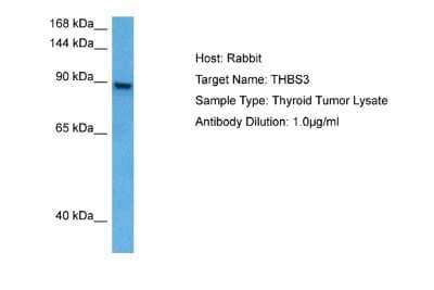 Western Blot: Thrombospondin-3 Antibody [NBP2-85913] - Host: Rabbit. Target Name: THBS3. Sample Tissue: Human Thyroid Tumor lysates. Antibody Dilution: 1ug/ml