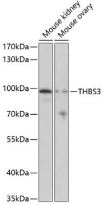 Western Blot: Thrombospondin-3 Antibody [NBP2-94865] - Analysis of extracts of various cell lines, using Thrombospondin-3 at 1:1000 dilution. Secondary antibody: HRP Goat Anti-Rabbit IgG (H+L) at 1:10000 dilution. Lysates/proteins: 25ug per lane. Blocking buffer: 3% nonfat dry milk in TBST. Detection: ECL Basic Kit . Exposure time: 90s.