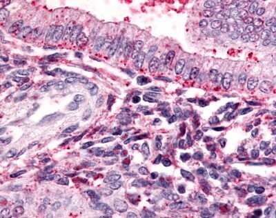Immunohistochemistry-Paraffin: Thromboxane A2 R/TBXA2R Antibody [NLS1277] - Analysis of anti-TBXA2R antibody with human uterus.