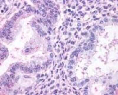 Immunohistochemistry-Paraffin: Thromboxane A2 R/TBXA2R Antibody [NLS1280] - Analysis of anti-TBXA2R antibody with uterus at 2.5 ug/ ml.