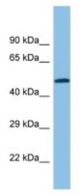 Western Blot: Thromboxane A2 R/TBXA2R Antibody [NBP3-10561] - Western blot analysis of Thromboxane A2 R/TBXA2R in U937 Whole cell lysates. Antibody dilution at 1.0ug/ml