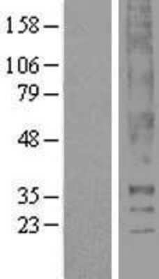 Western Blot: Thromboxane A2 receptor Overexpression Lysate (Adult Normal) [NBL1-16752] Left-Empty vector transfected control cell lysate (HEK293 cell lysate); Right -Over-expression Lysate for Thromboxane A2 receptor.