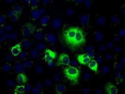 Immunocytochemistry/Immunofluorescence: Thromboxane synthase Antibody (OTI2C1) - Azide and BSA Free [NBP2-74505] - Staining of COS7 cells transiently transfected by pCMV6-ENTRY Thromboxane synthase.