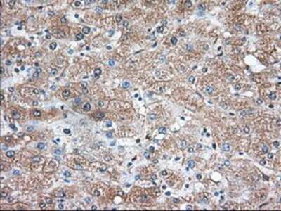 Immunohistochemistry: Thromboxane synthase Antibody (OTI2C1) - Azide and BSA Free [NBP2-74505] - Staining of paraffin-embedded Human liver tissue using anti-Thromboxane synthase mouse monoclonal antibody.