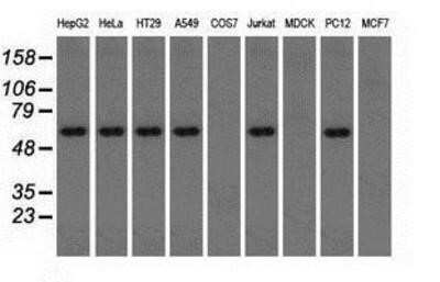 Western Blot: Thromboxane synthase Antibody (OTI2C1) - Azide and BSA Free [NBP2-74505] - Analysis of extracts (35ug) from 9 different cell lines by using anti-Thromboxane synthase monoclonal antibody.