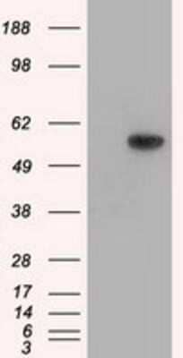 Western Blot: Thromboxane synthase Antibody (OTI2C1) - Azide and BSA Free [NBP2-74505] - HEK293T cells were transfected with the pCMV6-ENTRY control (Left lane) or pCMV6-ENTRY Thromboxane synthase (Right lane) cDNA for 48 hrs and lysed. Equivalent amounts of cell lysates (5 ug per lane) were separated by SDS-PAGE and immunoblotted with anti-T