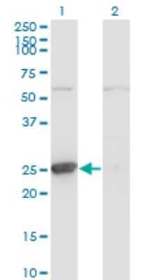 Western Blot: Thymidine Kinase 1 Antibody (3E2) [H00007083-M06] - Analysis of TK1 expression in transfected 293T cell line by TK1 monoclonal antibody (M06), clone 3E2. Lane 1: TK1 transfected lysatE (25.5 KDa). Lane 2: Non-transfected lysate.