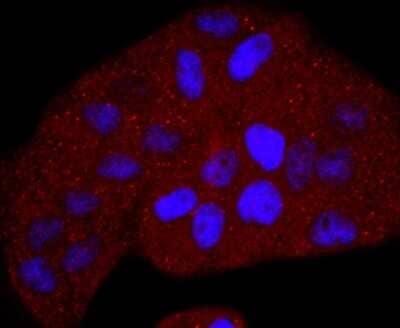 Immunocytochemistry/Immunofluorescence: Thymidine Kinase 1 Antibody (JF0970) [NBP2-67199] - Staining Thymidine Kinase 1 in Hela cells (red). The nuclear counter stain is DAPI (blue). Cells were fixed in paraformaldehyde, permeabilised with 0.25% Triton X100/PBS.