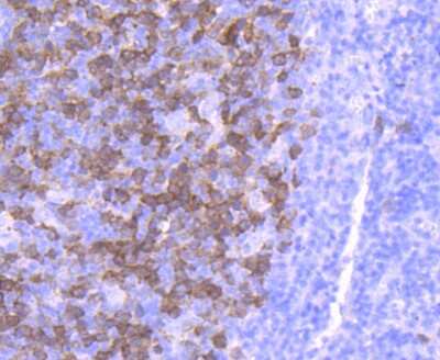 Immunohistochemistry-Paraffin: Thymidine Kinase 1 Antibody (JF0970) [NBP2-67199] - Analysis of paraffin-embedded human tonsil tissue using anti-Thymidine Kinase 1 antibody. Counter stained with hematoxylin.