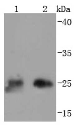 Western Blot: Thymidine Kinase 1 Antibody (JF0970) [NBP2-67199] - Analysis of Thymidine Kinase 1 on different lysates using anti-Thymidine Kinase 1 antibody at 1/1,000 dilution. Positive control: Lane 1: 293T Lane 2: Hela