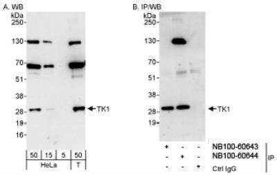 Western Blot: Thymidine Kinase 1 Antibody [NB100-60644] - Detection of Human TK1 on HeLa whole cell lysate using NB100-60644. TK1 was also immunoprecipitated by rabbit anti-TK1 antibody NB100-60643.