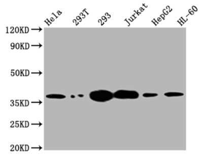 Western Blot: Thymidylate Synthase Antibody (2B2) [NBP3-15154] - Positive WB detected in: Hela whole cell lysate, 293T whole cell lysate, 293 whole cell lysate, Jurkat whole cell lysate, HepG2 whole cell lysate, HL-60 whole cell lysate. All lanes: Thymidylate Synthase antibody at 1:2000. Secondary: Goat polyclonal to rabbit IgG at 1/50000 dilution. Predicted band size: 36, 32, 27 KDa. Observed band size: 36 KDa.