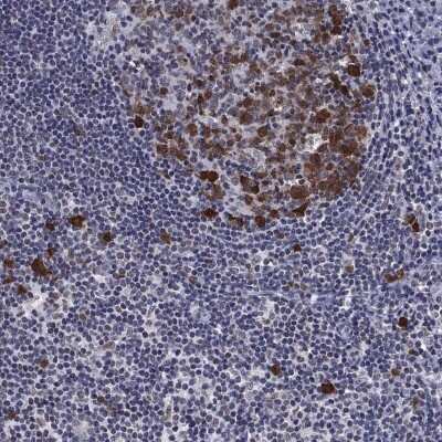 Immunohistochemistry-Paraffin: Thymidylate Synthase Antibody [NBP3-17004] - Staining of human tonsil shows high expression.