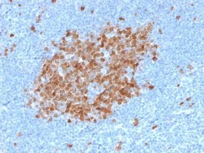 Immunohistochemistry-Paraffin: Thymidylate Synthase Antibody (TYMS/1884) [NBP3-08882] - Formalin-fixed, paraffin-embedded human Tonsil stained with Thymidylate Synthase Mouse Monoclonal Antibody (TYMS/1884).