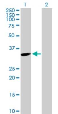 Western Blot: Thymidylate Synthase Antibody [H00007298-D01P] - Analysis of TYMS expression in transfected 293T cell line by TYMS polyclonal antibody.Lane 1: TYMS transfected lysate(35.70 KDa).Lane 2: Non-transfected lysate.