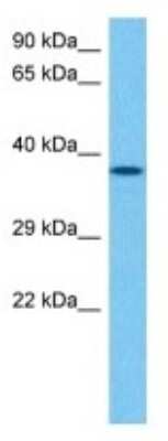 Western Blot: Thymidylate Synthase Antibody [NBP3-10109] - Western blot analysis of Thymidylate Synthase in Mouse Heart lysates. Antibody dilution at 1ug/ml
