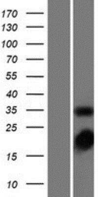 Western Blot: Thymidylate Synthase Overexpression Lysate (Native) [NBP2-08333] - Thymidylate Synthase Overexpression Lysate (Native) Left-Empty vector transfected control cell lysate (HEK293 cell lysate); Right -Over-expression Lysate for TYMS.