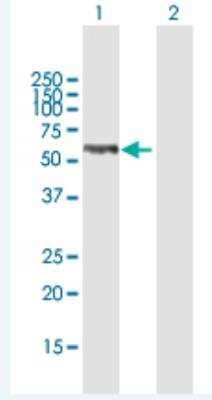 Western Blot: Thymopoietin/LAP2 Antibody [H00007112-B01P-50ug] - Analysis of TMPO expression in transfected 293T cell line (H00007112-T01) by TMPO MaxPab polyclonal antibody.  Lane 1: TMPO transfected lysate(49.94 KDa). Lane 2: Non-transfected lysate.