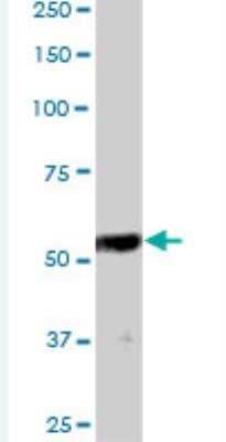 Western Blot: Thymopoietin/LAP2 Antibody [H00007112-B01P-50ug] - Polyclonal antibody. Western Blot analysis of TMPO expression in human placenta.