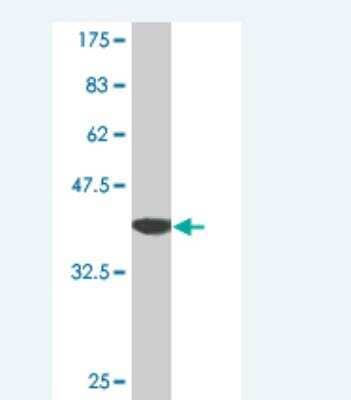 Western Blot: Thymosin alpha 1 Antibody (3E5.) [H00005757-M06] - Detection against Immunogen (37.73 KDa) .