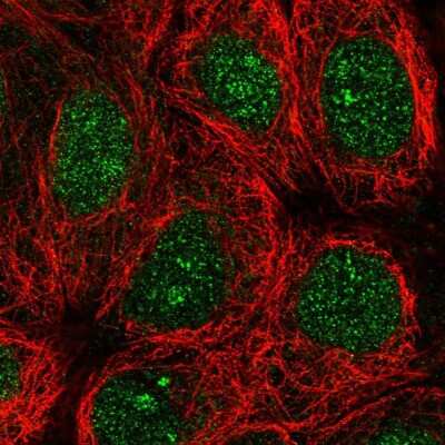 Immunocytochemistry/Immunofluorescence: Thymosin alpha 1 Antibody [NBP2-55714] - Staining of human cell line MCF7 shows localization to nucleus.
