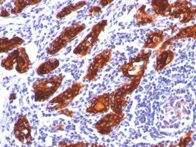 Immunohistochemistry-Paraffin: Thyroglobulin Antibody (2H11) - IHC-Prediluted [NBP2-45117] - Formalin-paraffin human thyroid gland stained with Thyroglobulin Ab (2H11).