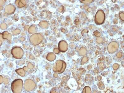 Immunohistochemistry-Paraffin: Thyroglobulin Antibody (TGB/1970R) [NBP3-07352] - Formalin-fixed, paraffin-embedded human Thyroid stained with Thyroglobulin Rabbit Recombinant Monoclonal Antibody (TGB/1970R).