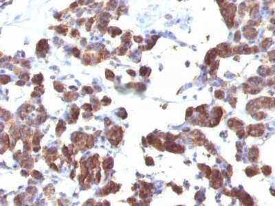 Immunohistochemistry-Paraffin: Thyroglobulin Antibody (TGB04 + TGB05) [NBP2-45122] - Human Thyroid stained with Thyroglobulin Monoclonal Antibody (TGB04 + TGB05).