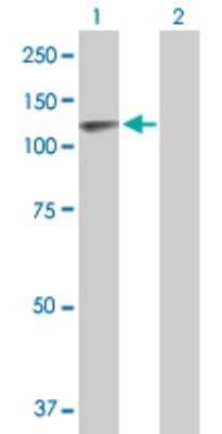 Western Blot: Thyroid Peroxidase Antibody [H00007173-B01P] - Analysis of TPO expression in transfected 293T cell line by TPO polyclonal antibody.  Lane 1: TPO transfected lysate(102.63 KDa). Lane 2: Non-transfected lysate.