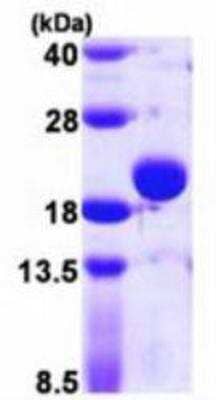 SDS-Page: Recombinant E. coli Thiol Peroxidase Protein [NBP1-78805] -  15% SDS-PAGE (3 ug).