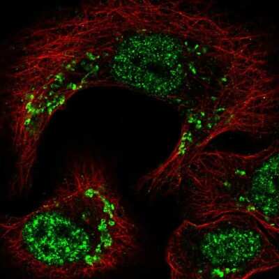 Immunocytochemistry/Immunofluorescence: Thyroid receptor-interacting protein 11 Antibody [NBP2-57415] - Staining of human cell line HaCaT shows localization to nuclear speckles & the Golgi apparatus.
