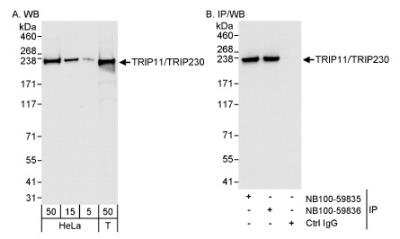 Western Blot: Thyroid receptor-interacting protein 11 Antibody [NB100-59835] - Detection of Human TRIP11/TRIP230 on HeLa whole cell lysate using NB100-59835. TRIP11/TRIP230 was also immunoprecipitated by rabbit anti-TRIP11/TRIP230 antibody NB100-59836.